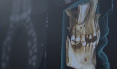 La importancia del cuidado dental para una vida saludable